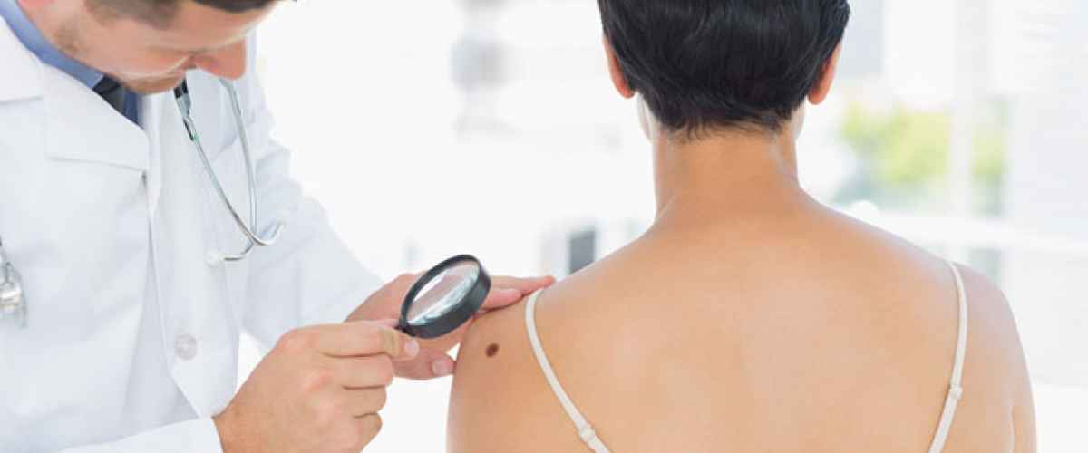 Dermatologen svarar på frågor om hudcancer 