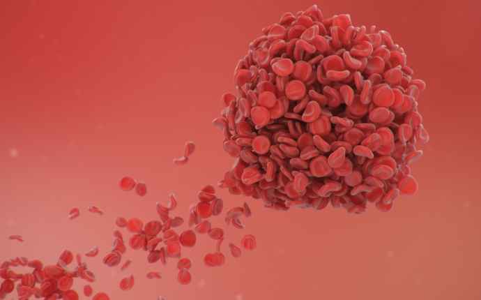 Myelompatienter löper ökad risk för blodproppar 