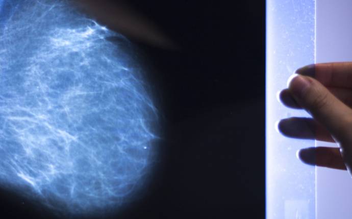 Olika typer av bröstcancer, symtom och mammografi