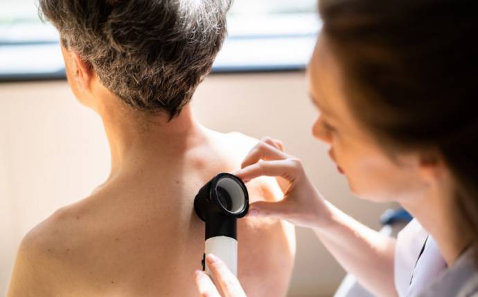 Personer med KLL har ökad risk för hudcancer