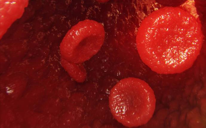 Ovanliga diagnoser - bild på röda blodkroppar